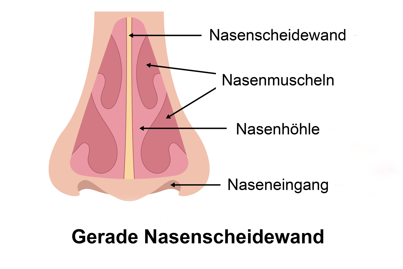 schema-nasenscheidenwand Schema einer Nasenscheidewand